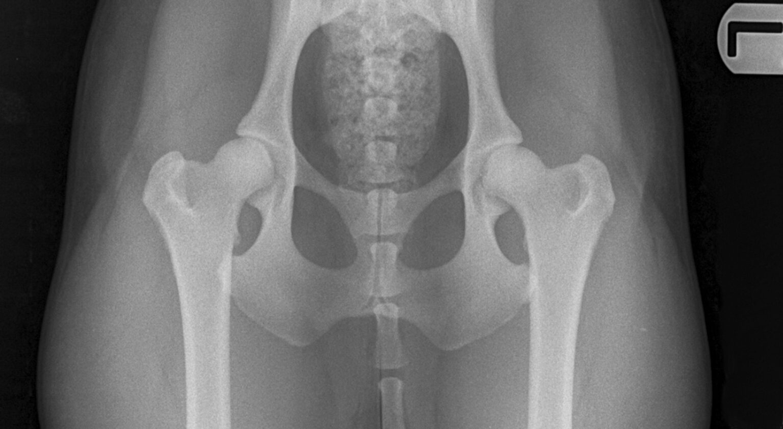 xray images of normal male hips